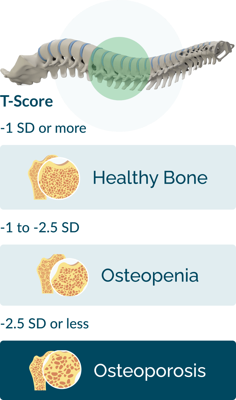 t-scrore_spinal_cord_mobile